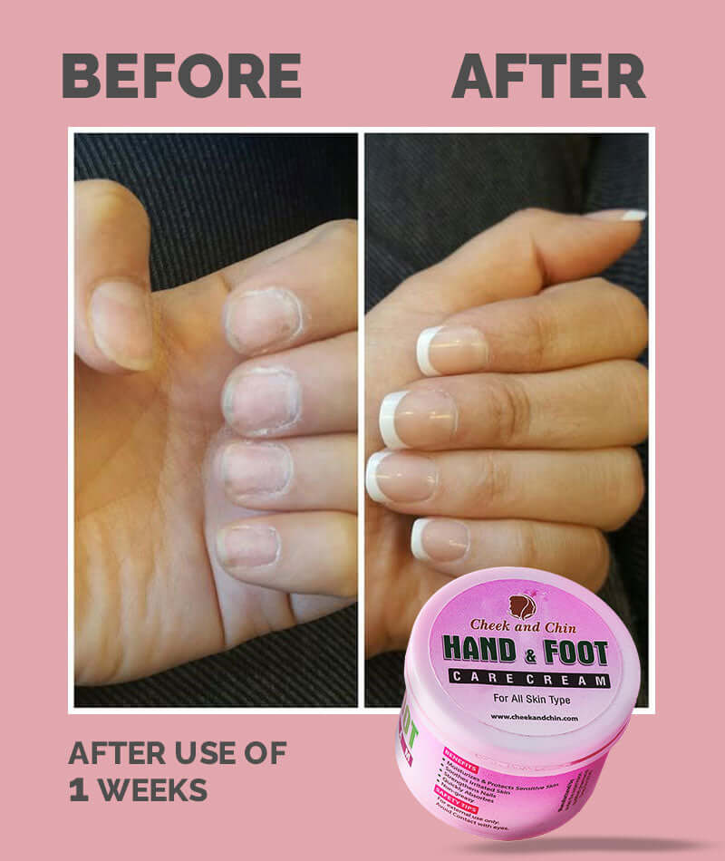 Deep Moisturizing Hand & Foot Care Cream – Nourishing Formula for Dry, Sensitive Skin, Protection and Softness