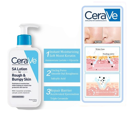 CeraVe - SA Lotion for Rough & Bumpy Skin