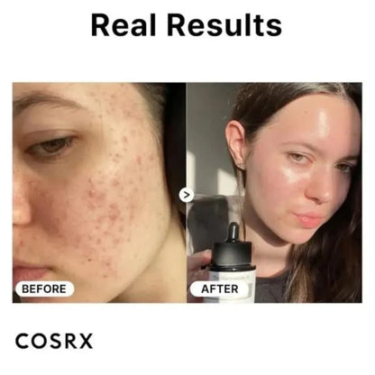COSRX The Hyaluronic Acid 3 Serum - 20ml